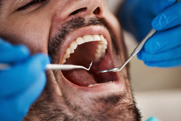 Best Emergency Dental Care for Broken or Chipped Teeth in Augusta, KS