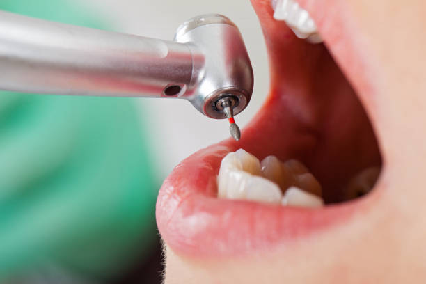 Best Emergency Gum Treatment in Augusta, KS